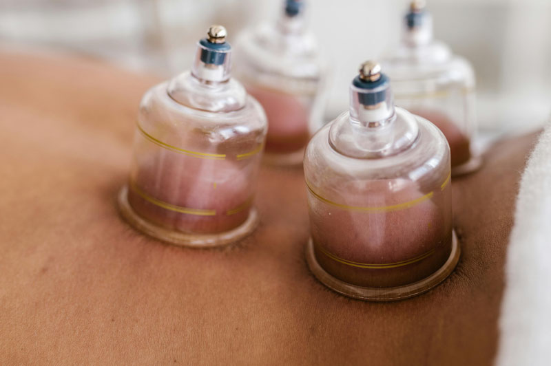 dr-khan-holistic-health-cupping dr-khan-holistic-health-cupping